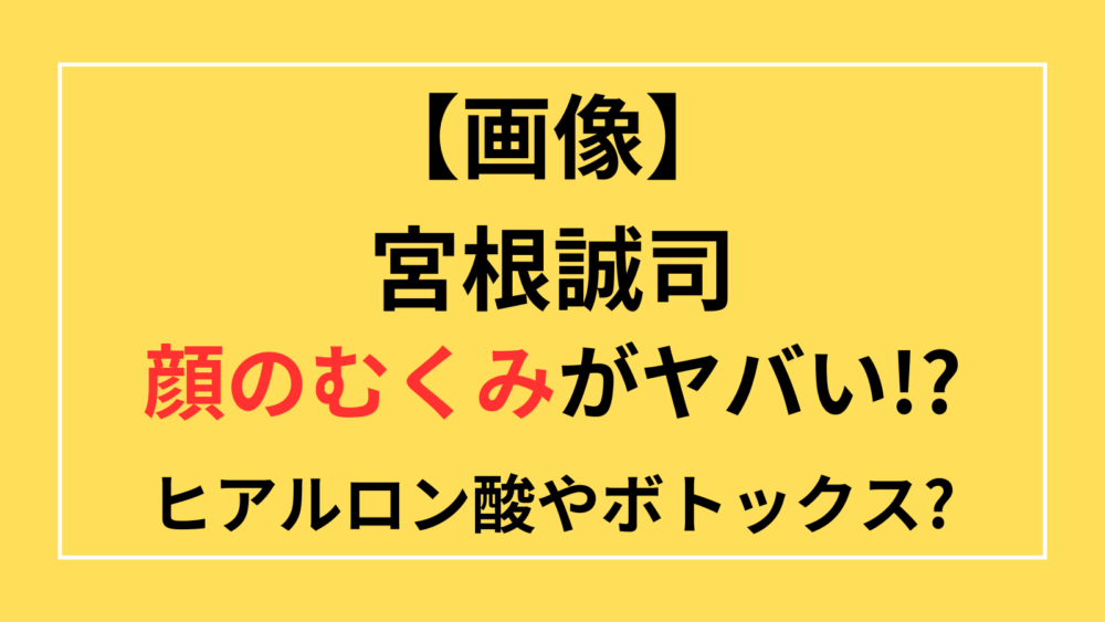 宮根誠司　顔のむくみ　ヒアルロン酸　ボトックス