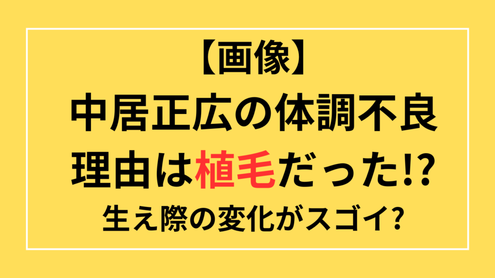 中居正広　体調不良　理由　植毛　生え際　変化　画像